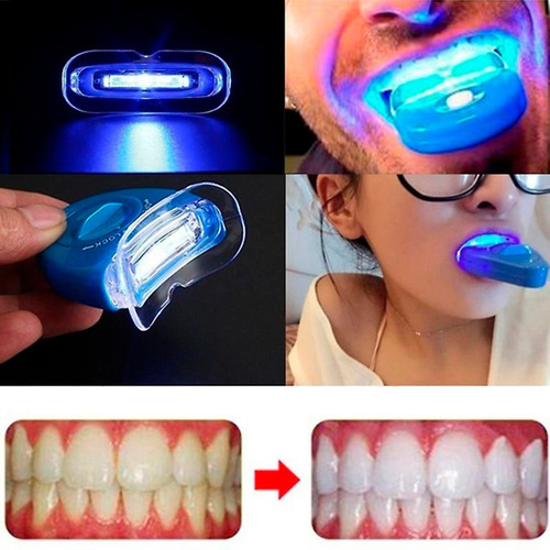 Lápis clareador e seringa para reparação de dentes e removedor de tártaro dentário