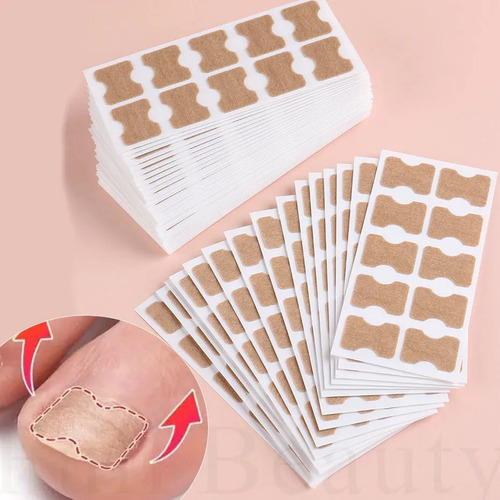 Kit 30 Adesivos Órtose Correção De Unhas Encravadas