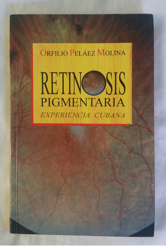 Retinosis Pigmentaria Orfilio Pelaez Molina