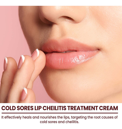 Crema Labial Para Herpes Y Queilitis: Nutre Y Embellece Los