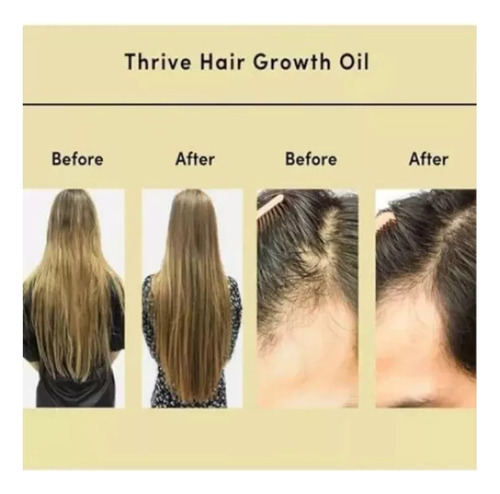 4pcs Aceite Esencial Para Cuidado Del Cabello Veganic Hair