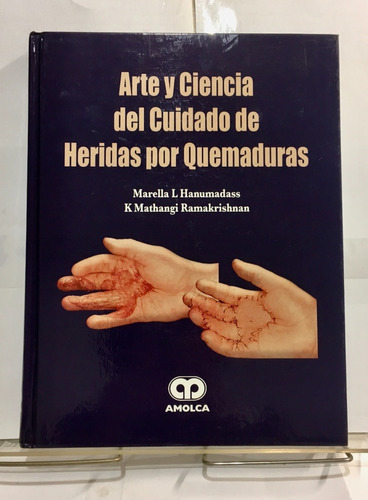 Arte Y Ciencia Del Cuidado De Heridas Por Quemaduras 