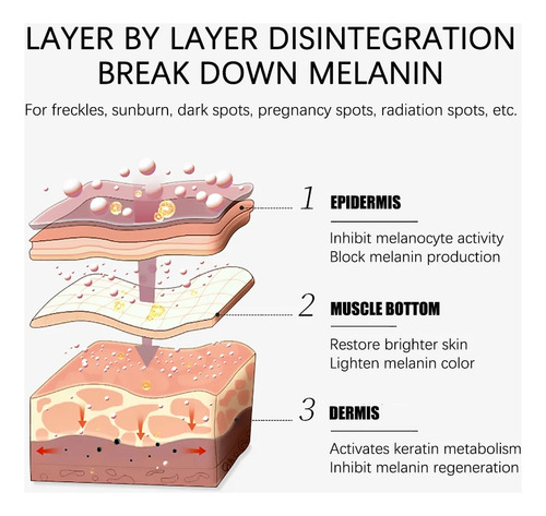 Crema Para Eliminar Manchas Y Manchas De Melasma, Blanqueado