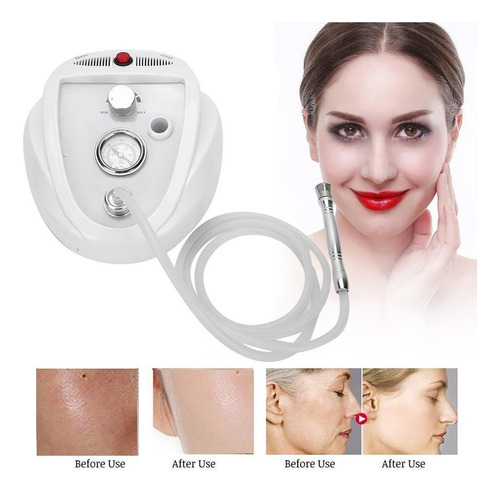 Máquina De Peeling Facial Microdermoabrasión Limpieza