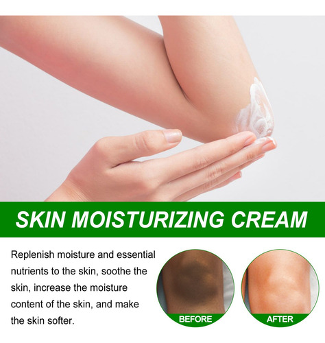 Para 3×crema Para Blanquear Las Axilas Y Aclarar Axilas