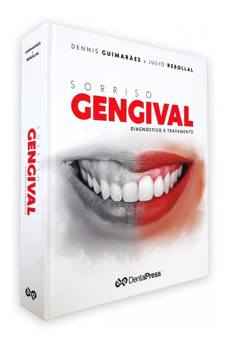 Livro: Sorriso Gengival - Diagnóstico E Tratamento