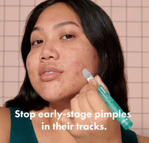 Hero Pimple-correct Boligrafo De Gel Para Limpiar El Acne