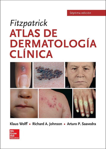 Atlas De Dermatología Clínica Fitzpatrick Séptima Edición