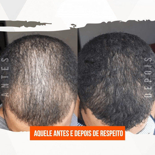 Imagem 6 de 8 de Remédio Cresce Cabelo Biotina Aumento Brilho Dos Fios Unisex