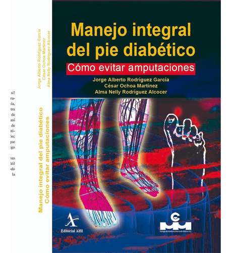 Manejo integral del pie diabético, de Rodríguez, Jorge Alberto. Editorial Alfil, tapa blanda en español, 2020