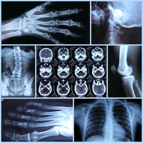 Radiografías Lote Por 3 Unidades