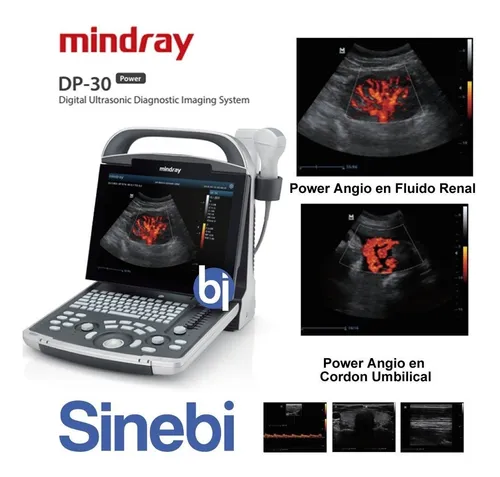 Ecografo Mindray Dp-30pwp Power Angio Color + Transductor