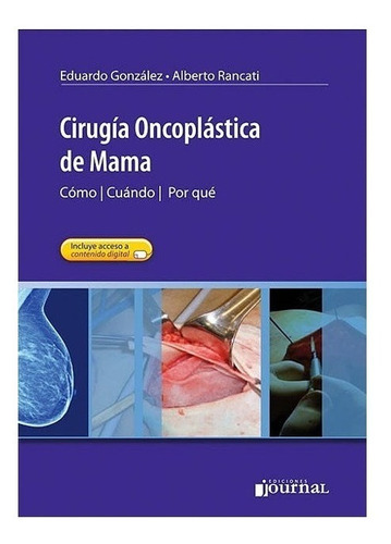 Cirugía Oncoplástica De Mama. Cómo, Cuándo, Por Qué