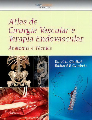 Atlas De Cirurgia Vascular E Terapia Endovascular, De Cambria P.. Editora Gen Guanabara Koogan Em Português