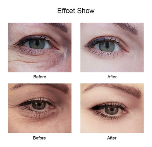 Imagen 3 de 3 de Parches Hydrogel Contorno Ojos Acido Hialuronico Vitamina Re