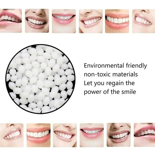 Imagen 4 de 6 de Kit Diente Provisorio Para Reemplazar Un Diente Easy Teeth