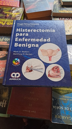 Histerectomía Para Enfermedad Benigna, Amolca