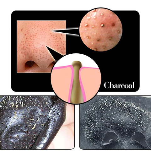 Shills Blackhead Remover, Control De Poros, Limpieza De La 1