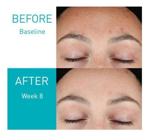 Sérum Resurfacing Retinol Serum Gwynne Retinol Serum