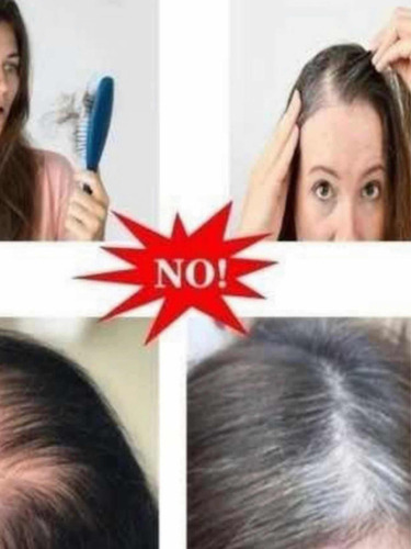 Prótese Topo Franja Cabelo Humano Castanho Cacheado 45/50cm