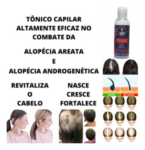 Tônico Capilar Para Fortalecimento De Cabelo Fino E Frágil!!