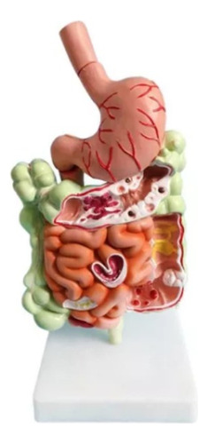 Modelo Sistema Digestivo Humano Anatomia Do Estômago Intesti