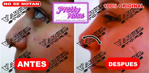 Imagen 4 de 5 de Corrector Nasal Nariz Bonita / Pretty Nouse Pack De 8 Pares