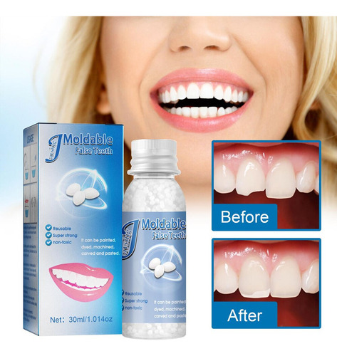 Pegamento Dental Moldeable De Resina Dental, 3 Unidades, 30