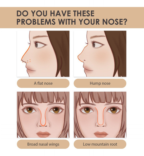 E 30 Ml Nasal Mejora La Forma Y Del Nasal 8031