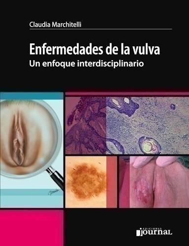 Enfermedades De La Vulva Un Enfoque Interdisciplinario - Ma