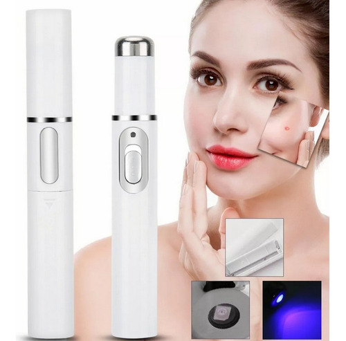 Caneta Laser Luz Azul Acne Terapia Cicatriz Portátil Tipo de pele Todo tipo de pele