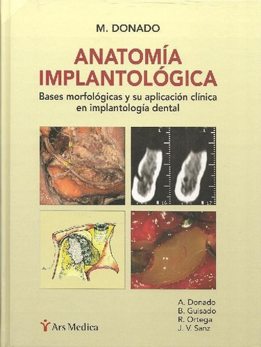 Libro Anatomia Implantológica De Manuel Donado Rodriguez