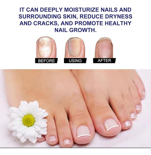 Plant Drops - Plant Drops For El Cuidado De Las Uñas,