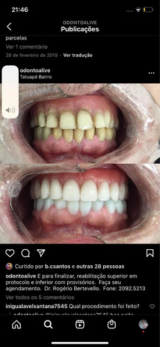 Imagem 2 de 4 de Implantes Dentários