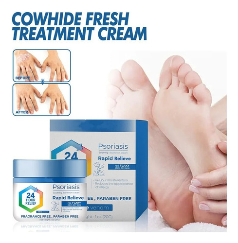 3. Solución Eficaz Para La Psoriasis Eccematoide Sin Tratami