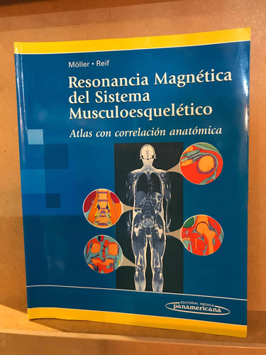 Resonancia Magnética Del Sistema Musculoesquelético.