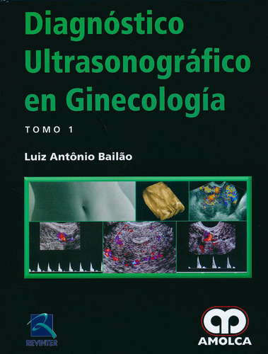 Diagnostico Ultrasonografico Ginecologia 2 Vols