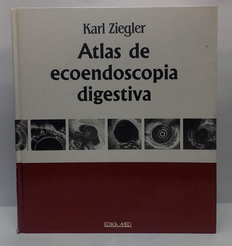 Atlas De Ecoendoscopia Digestiva