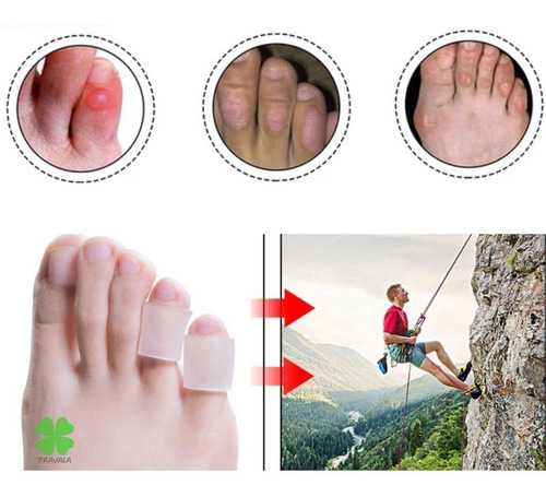 Imagem 2 de 10 de Corretor Dedo Pes Gel Joanete Pé Silicone Anti Bolhas Lesão