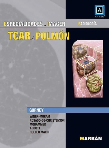 El Tcar De Pulmn Especialidades En Imagen Radiologaiui