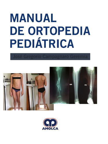 Manual De Ortopedia Pediátrica, De Campagnaro, J.. Editorial Amolca, Tapa Dura En Español, 2019