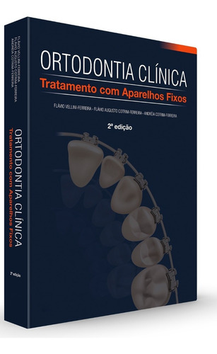 Livro Ortodontia Clínica Tratamento Com Aparelhos 2ª Vellini