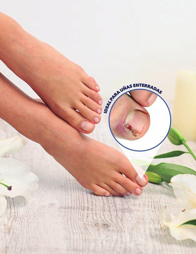 Imagen 3 de 3 de Stanhome Soft Toenail Tratamiento Para Uñas (ablandador) 5 Ml