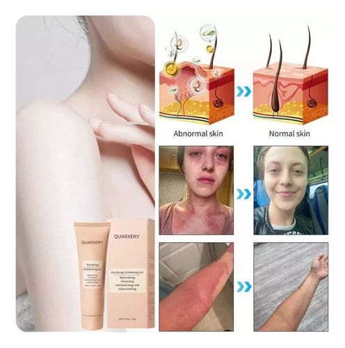 Quarxeri Purificante Exfoliante, Gel Exfoliante Avanzado 2 P