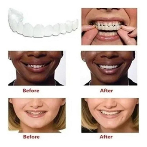 Silicona Superior/inferior Sorriso Dentes Falsos Folheados W