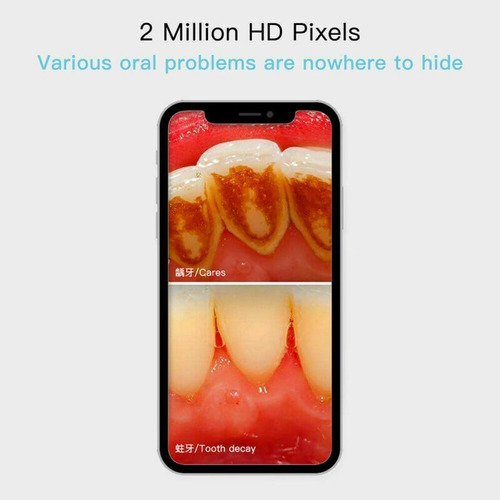 Imagen 3 de 8 de Camara Intraoral Odontologia Inalámbrica Dental Wifi Led