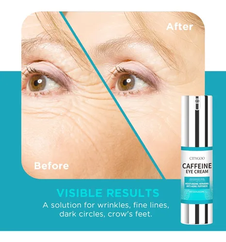 Crema De Ojos Con Cafeína Para Ojera, Bolsas, Arrugas