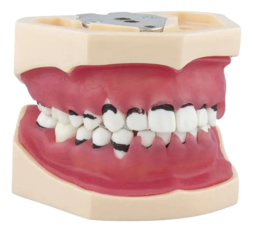 Modelo De Practica Periodoncia Completo Dental Odontologia