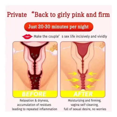 Yyds+ Cápsulas Vaginales De Reparación Natural,3pci