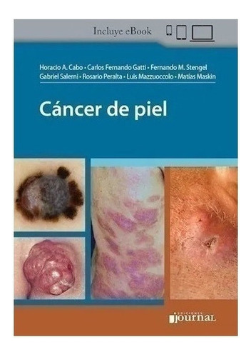 Cáncer De Piel Cabo Nuevo!